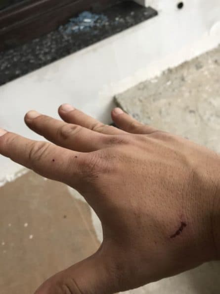 mici accidente de munca