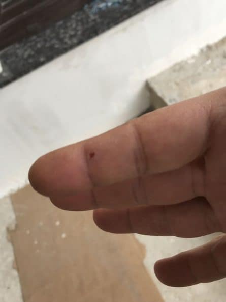 mici accidente de munca